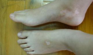 下霰是什么征兆